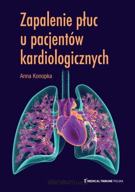 e79a6a033225ffc4364aa25357862f82